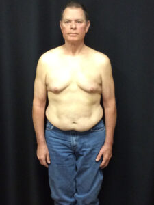After Image: Weight Loss