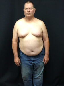 Before Image: Weight Loss