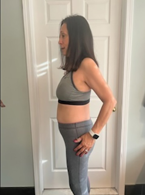 After Image: Weight Loss - left-side