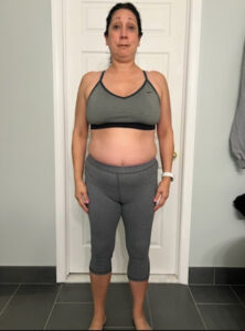 Before Image: Weight Loss