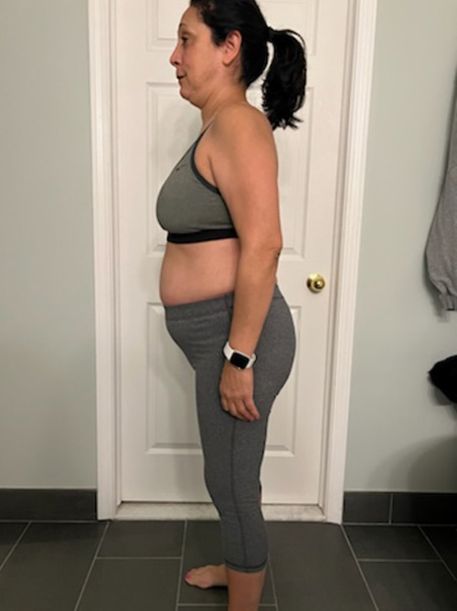 Before Image: Weight Loss - left-side